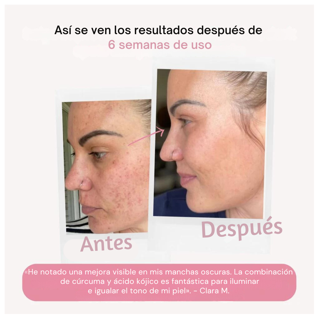 10%OFF- Almohadillas Iluminadoras YouGlow™